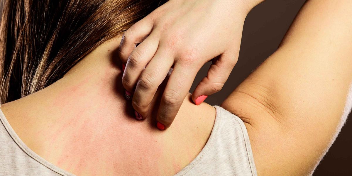 Allergy, best allergy center in lahore, best allergy specialist in lahore